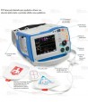 Monitor/Desfibrilador profesional R Series de Zoll