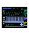 Monitor/Desfibrilador profesional X Series de Zoll